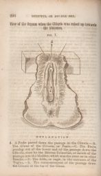 View of the Organs when the clitoris was raised toward the abdomen