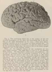 Fig. 5: The opposite halves of the cerebrums of two unlike persons.