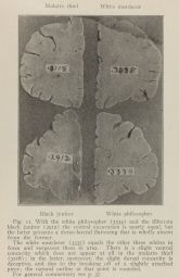 Fig. 11: Transections of four brains.